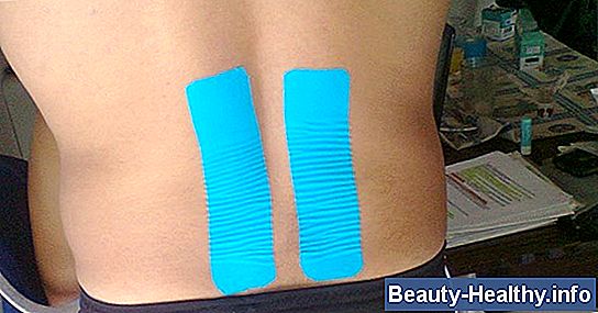 Técnicas de taping fascitis plantar