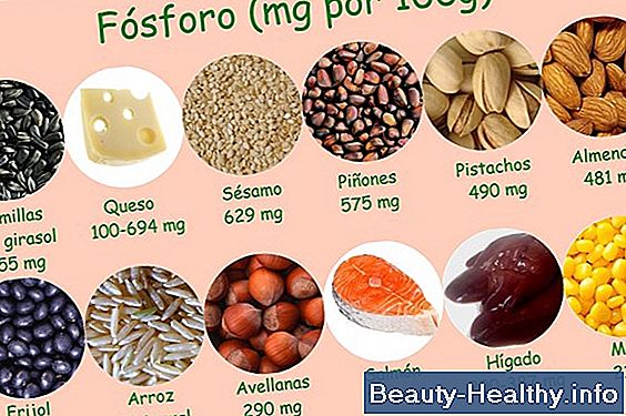 Alimentos para comer que son buenos para las infecciones del tracto urinario