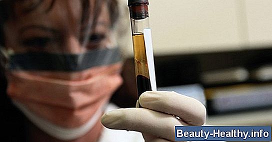 Cómo interpretar los resultados de la prueba de sangre del MPV