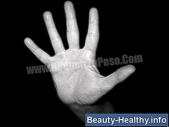 C贸mo usar agua con lim贸n para perder peso