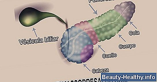 10 señales de advertencia de cáncer de colon