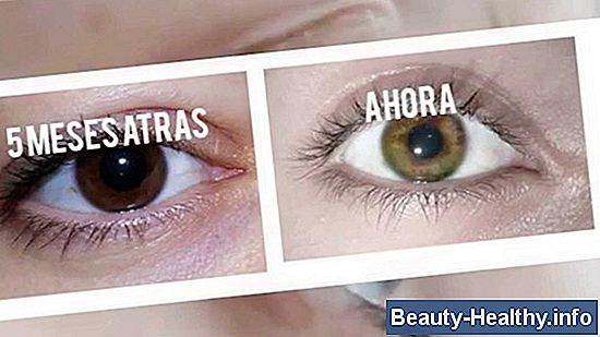 Acerca de las gotas para los ojos que cambian el color de tus ojos