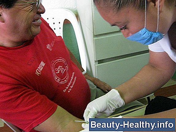 Acerca del sangrado rectal femenino