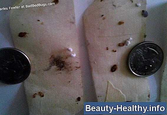 Chiggers vs. garrapata