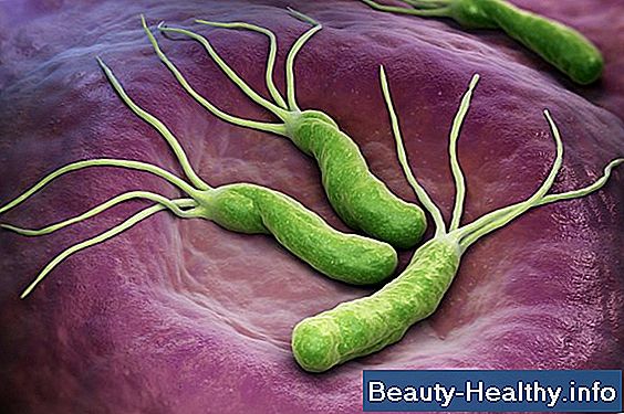 驴C贸mo atrapas H Pylori Bacteria