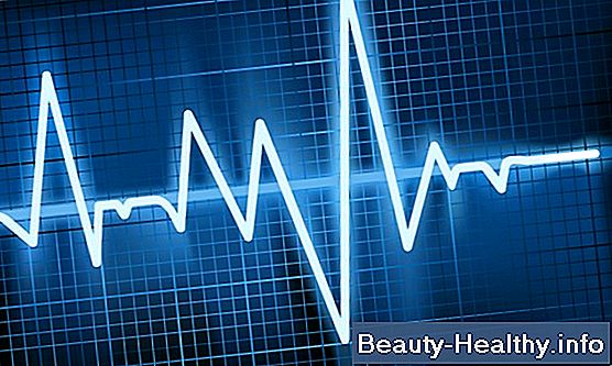 C贸mo calcular la frecuencia card铆aca en un EKG