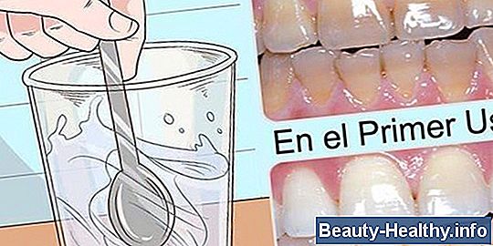 Cómo curar el hongo de uñas naturalmente con peróxido