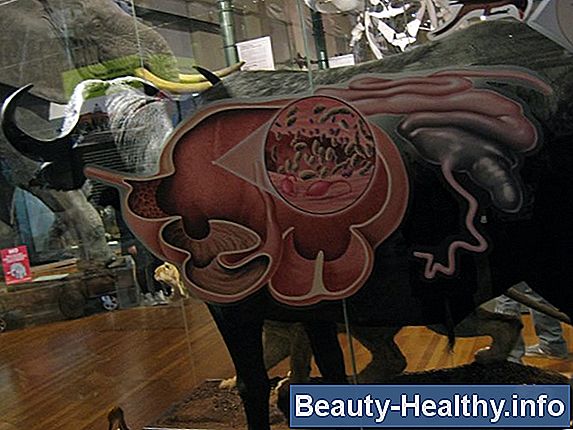 C贸mo deshacerse de las bacterias en el est贸mago
