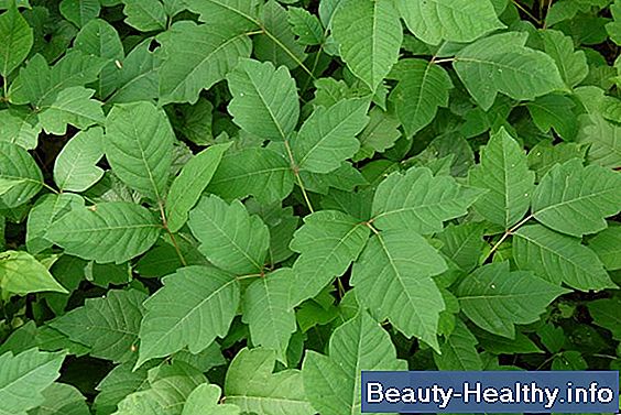 C贸mo deshacerse de Poison Oak Rash & Itch