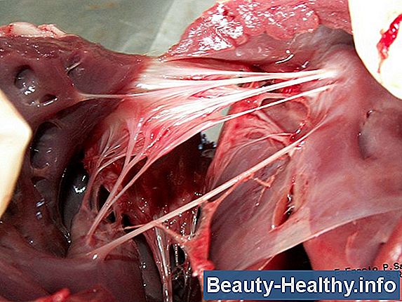 Cómo detectar el líquido en los síntomas pulmonares