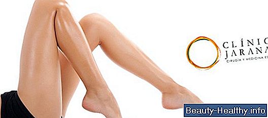 C贸mo detener la celulitis