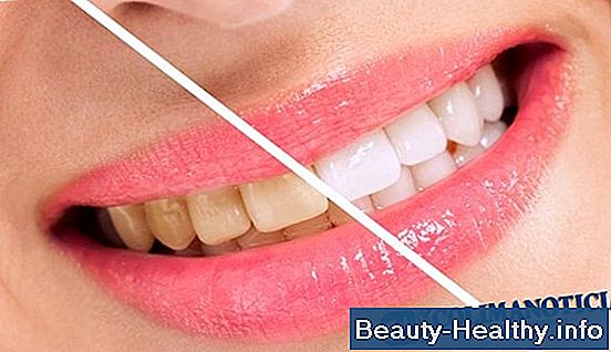 C贸mo eliminar la placa endurecida entre los dientes