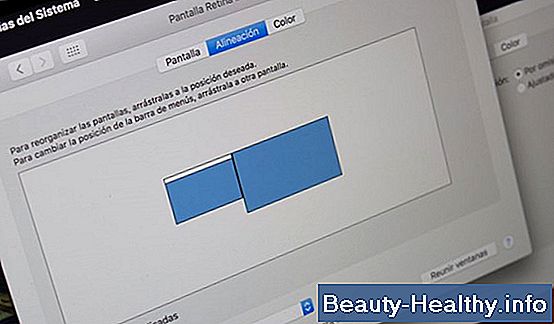 ¿Cómo funciona un Air Cast?