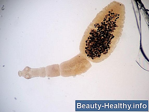 C贸mo identificar gusanos intestinales humanos