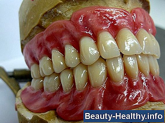 C贸mo identificar las dentaduras