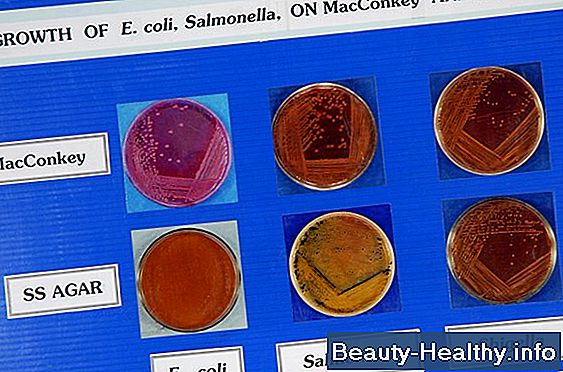 C贸mo leer los resultados de la prueba de sangre EBV