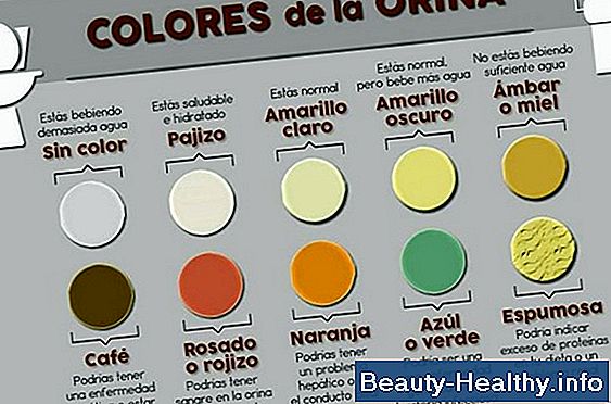 Color de las tiras de orina para la cetosis
