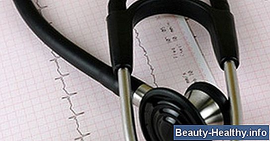 C贸mo leer un EKG para Dummies