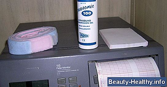 C贸mo leer una tira de monitor fetal