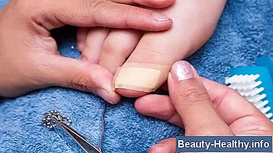 Cómo manejar las úlceras bucales de la quimioterapia