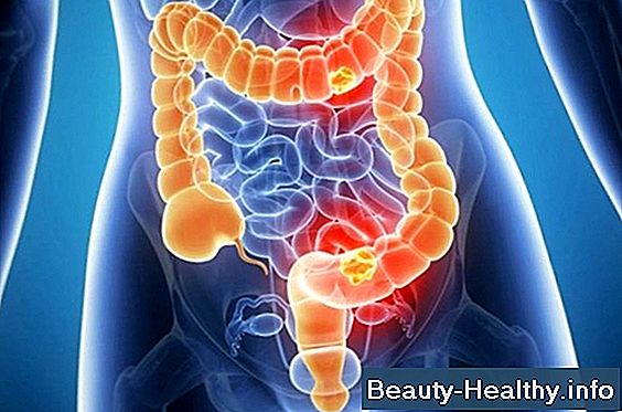 Cómo matar C-Diff en lavandería