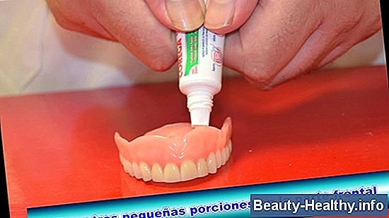 Adhesivos para dentaduras postizas m谩s duraderos
