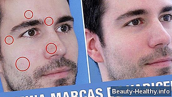 Cómo quitar el aserrín de tu ojo