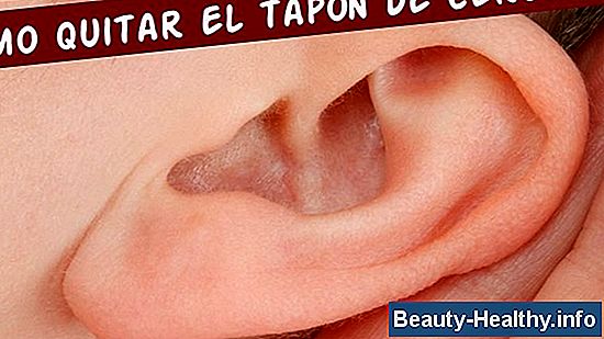 Cómo quitar la cera del oído con succión