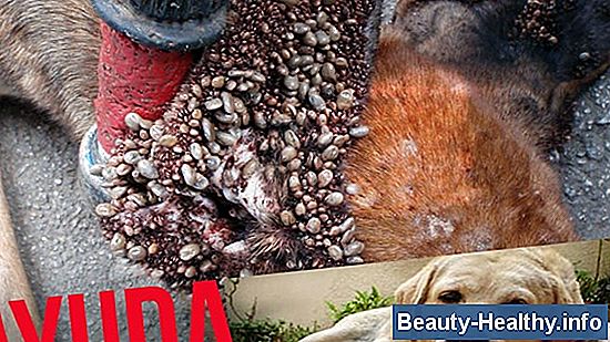 Cómo quitar las garrapatas de los oídos de los niños