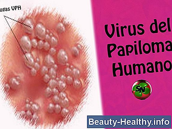 C贸mo saber si una infecci贸n por estafilococo es curativa