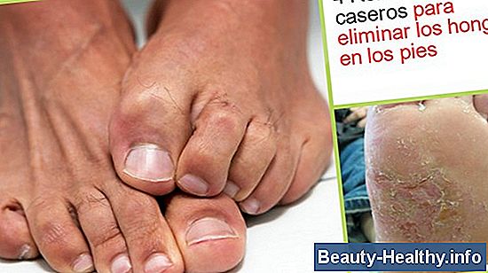 C贸mo sanar las manos secas y agrietadas con vinagre