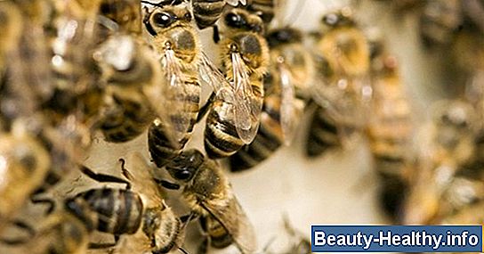 C贸mo tratar un pie hinchado por una picadura de insecto