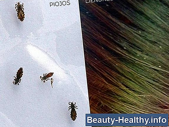 Cómo tratar un sofá para piojos