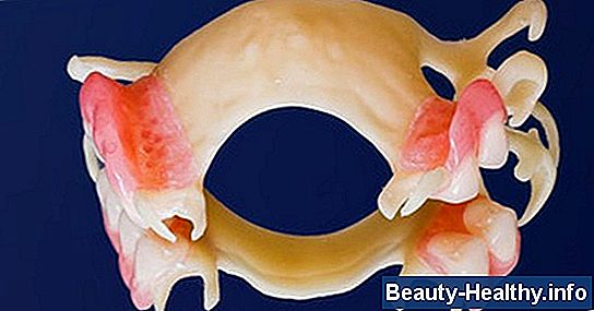 Costo de las dentaduras vs. Implantes