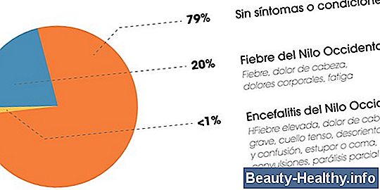 ¿Cuáles son los signos y síntomas de los fibromas uterinos después de la menopausia?