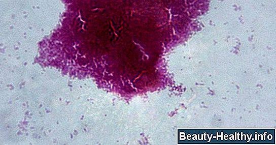 ¿Cuáles son los tratamientos para Serratia Bacteria?