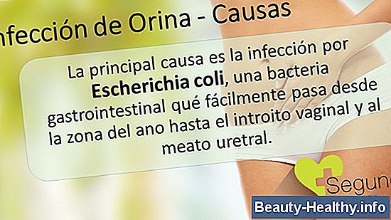 ¿Cuánto dura una infección por levadura sin medicación?