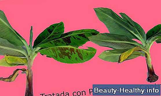 Diferencias entre Robitussin y Robitussin-DM