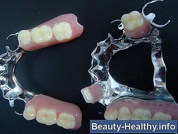 El costo promedio de los dientes de limpieza profunda