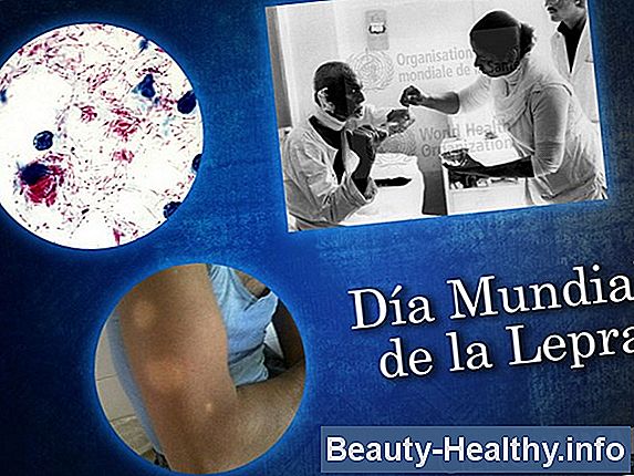 Enfermedad cr贸nica de la materia blanca