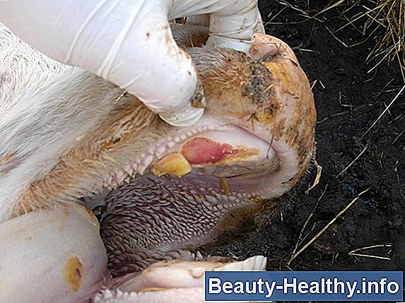 ¿Es contagiosa una infección del oído?