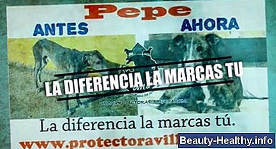 Etapa final de la insuficiencia card铆aca congestiva