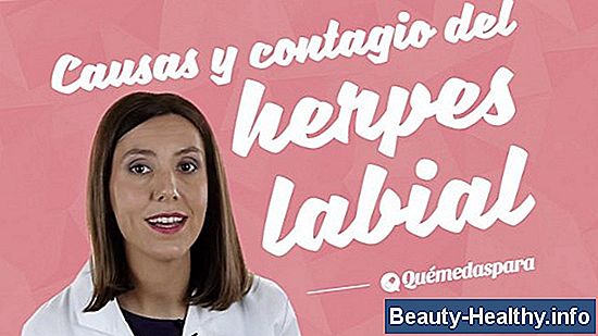 Etapas del herpes labial