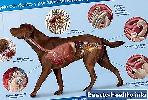 Gusanos de sangre en humanos