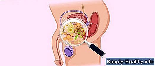 Infecci贸n del tracto urinario Tratamientos caseros