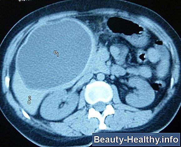 Inyecci贸n Lipotr贸pica para Perder Peso