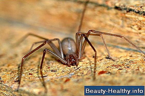 Los s铆ntomas de una picadura de chaqueta amarilla