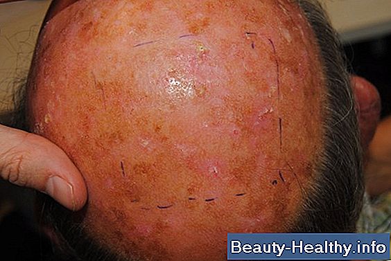 ¿Por qué me cae el pelo en las piernas?