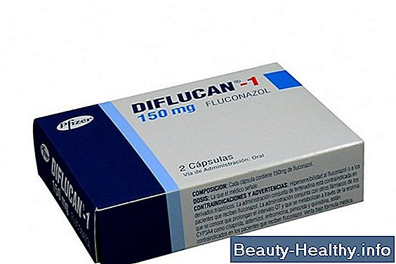 驴Puedes comprar Diflucan sin receta?