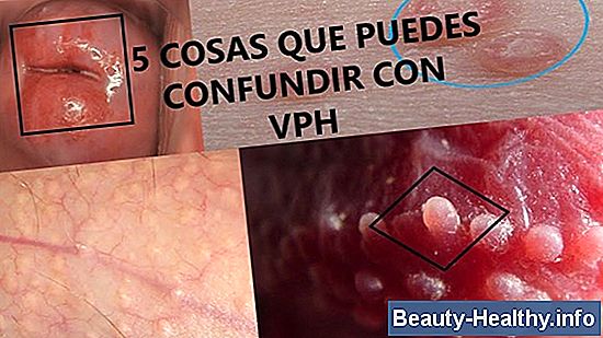 驴Qu茅 aspecto tiene el VPH en la boca?